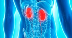 パーキンソン病は脳ではなく、実は腎臓が原因の病気かもしれないの画像 1/3