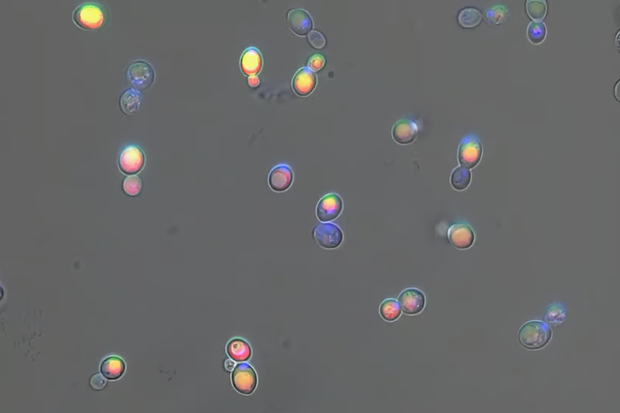 「尿から高価な物質を生成する」酵母の開発に成功の画像 3/4