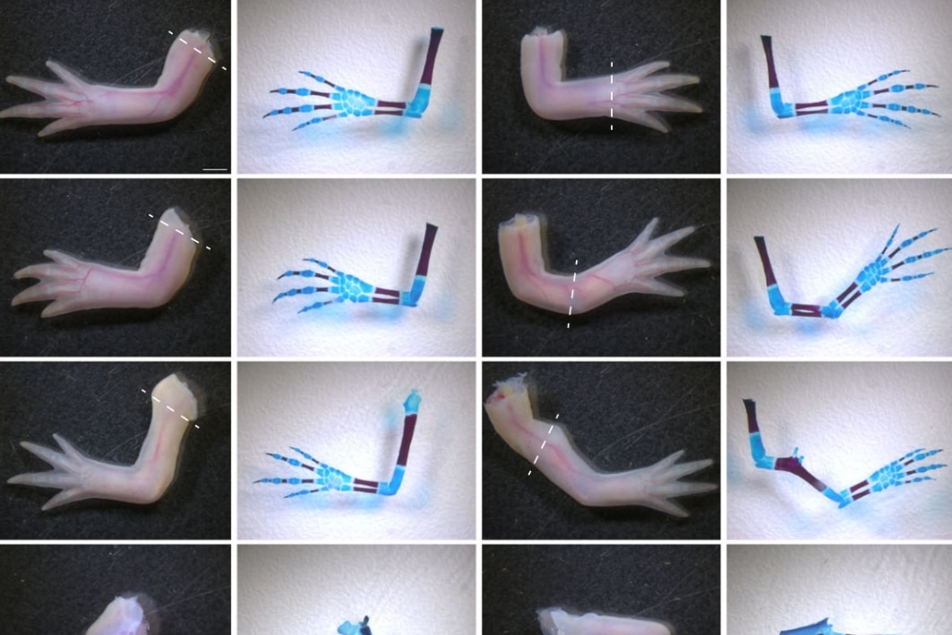 ニキビ薬成分が手足再生メカニズムを制御していたと判明