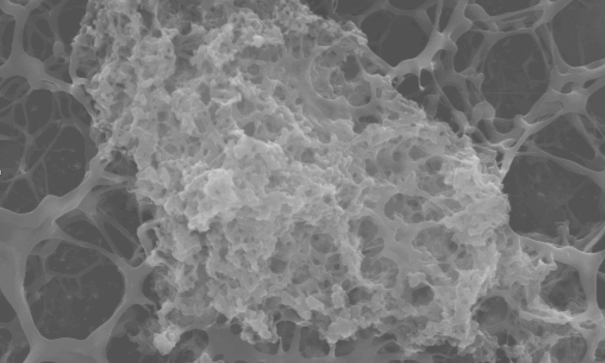 ”ノミの跳躍を生むタンパク質”から細菌を100%跳ね返すコーティングを開発の画像 4/4