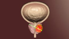 男性の前立腺は快楽の泉