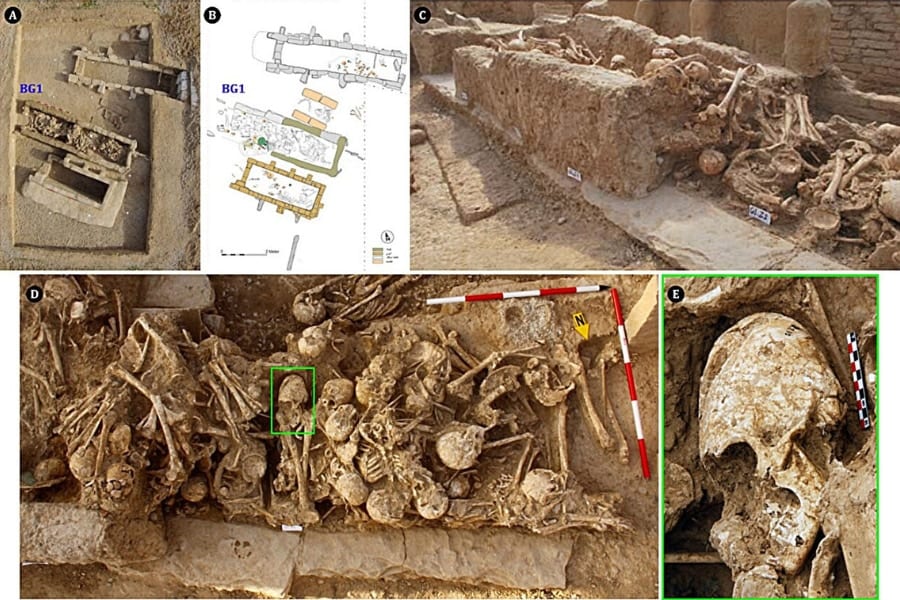 6200年前の「10代の少女の遺骨」を発見！頭がコーン型に整形