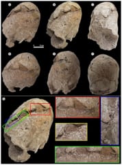6200年前の「10代の少女の遺骨」を発見！頭がコーン型に整形の画像 3/3