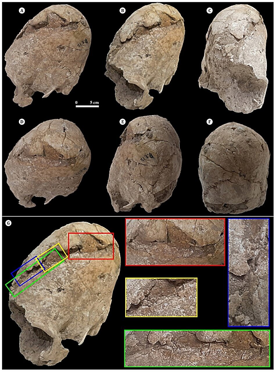 6200年前の「10代の少女の遺骨」を発見!頭がコーン型に整形の画像 3/3