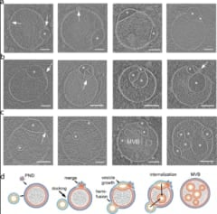 ヒト細胞に「未知の小器官」を新発見！「ヘミフュソーム」と命名の画像 3/3