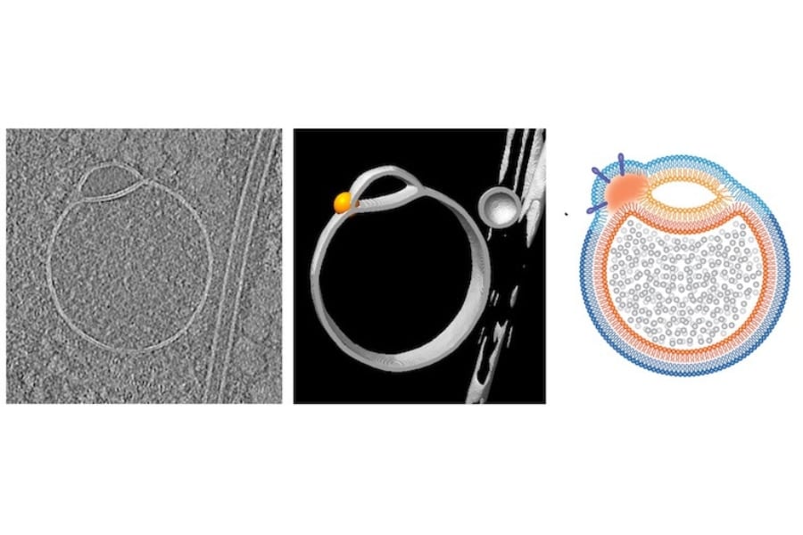 ヒト細胞に「未知の小器官」を新発見！「ヘミフュソーム」と命名