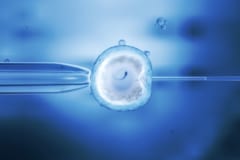 「3人の実の親」を持つ子供が8人誕生の画像 3/4