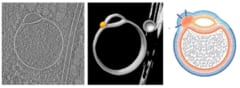 ヒト細胞に「未知の小器官」を新発見！「ヘミフュソーム」と命名の画像 2/3