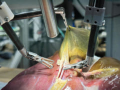 自律型のロボット外科医が人間の手を借りずに臓器摘出手術を成功させるの画像 3/3