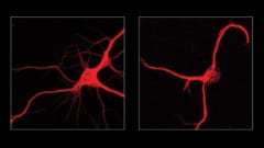 ペトリ皿で培養されたニューロンは、複数の「腕」を持つ分岐したワイヤー、つまりニューライトを発達させます。これらのニューロンをFTL1タンパク質を大量に産生するように改変すると、ニューライトははるかに単純になり、ほとんど分岐しなくなりました。
