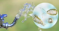 致死率97%の「脳食いアメーバ」が水道水から発見されるの画像 1/4