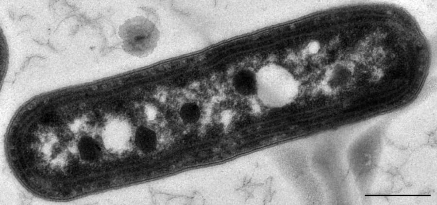 シアノバクテリア(Synechococcus elongatus)
