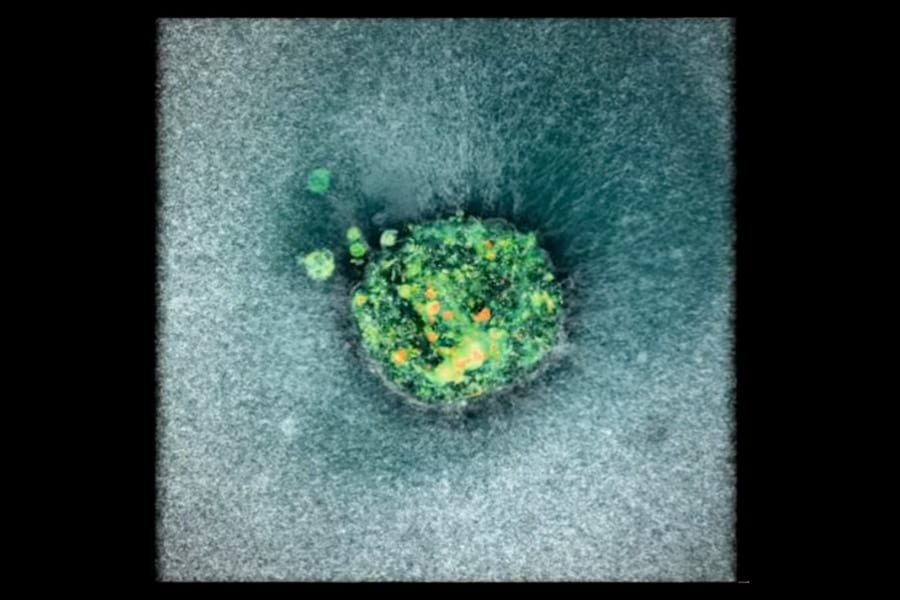 世界初！受精卵が子宮に着床する「瞬間」のリアルタイム撮影に成功