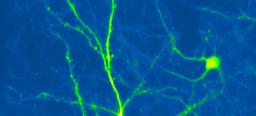 感覚の『揺らぎ』はなぜ起こる?脳科学が迫った長年の謎