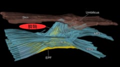 おへその形を決定する新しい腹部構造を発見！