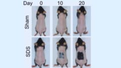 「傷跡にやたら毛が生えてくる」仕組みを利用した発毛法を発見