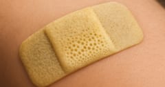 生きた菌類から「新型バンドエイド」が開発できるの画像 1/1