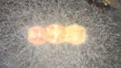 「耳」の役割を疑う研究者たちの挑戦――そこには卵を守るバリア菌栽培ポッドがあった