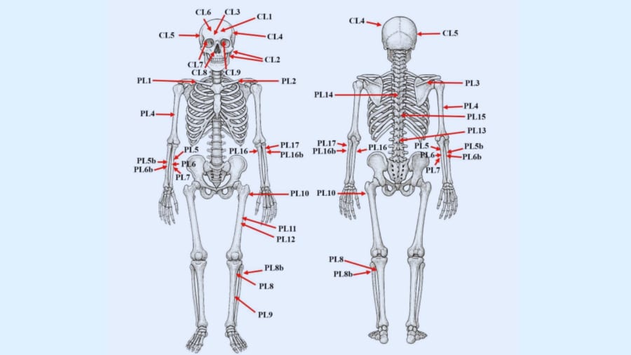 26ヵ所の傷後の分布