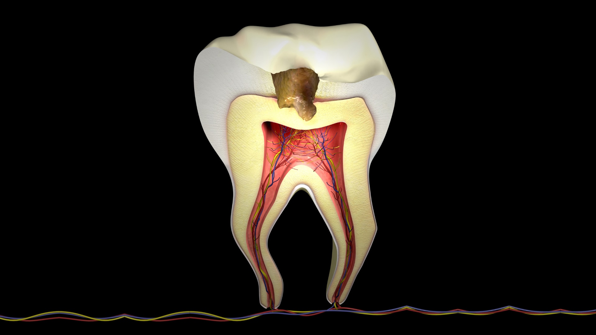 歯のエナメル質を修復するジェルが誕生――虫歯治療に革命か？の画像 4/4