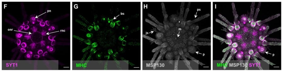 人間はずっとウニを誤解していた