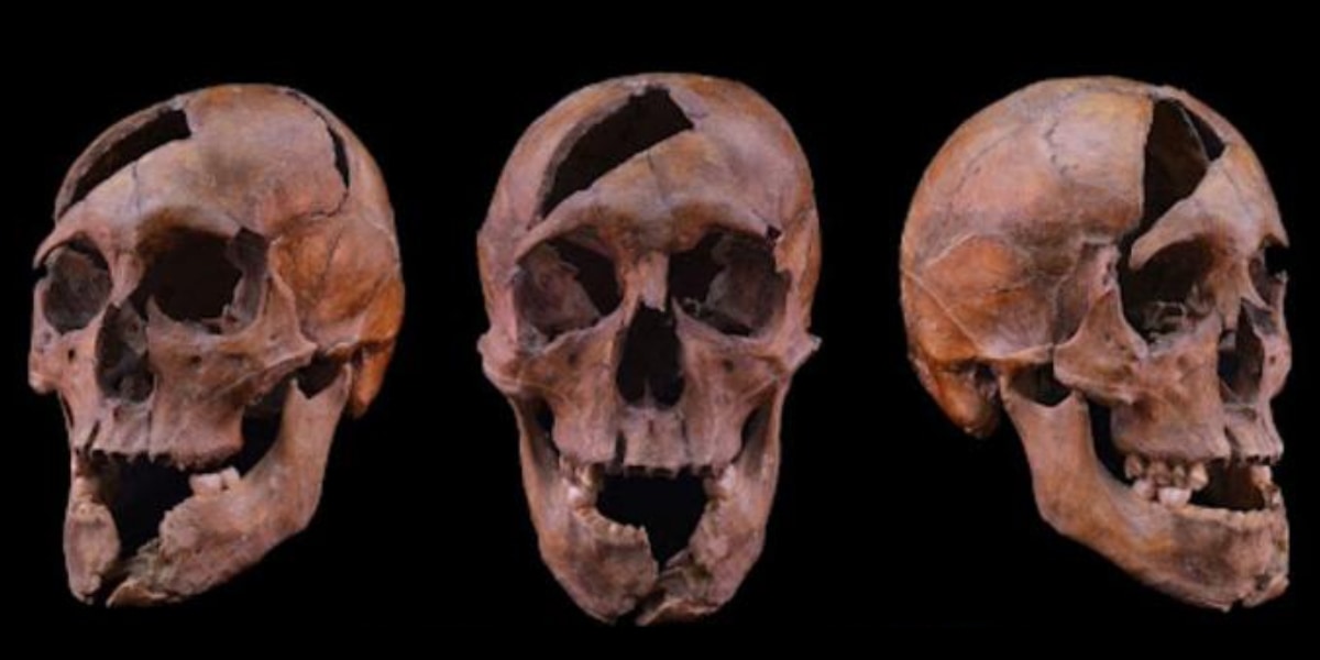 1272年に暗殺された公爵――26ヵ所の傷でオーバーキルされていた