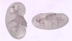 実験で使用された人工の腎臓モデル