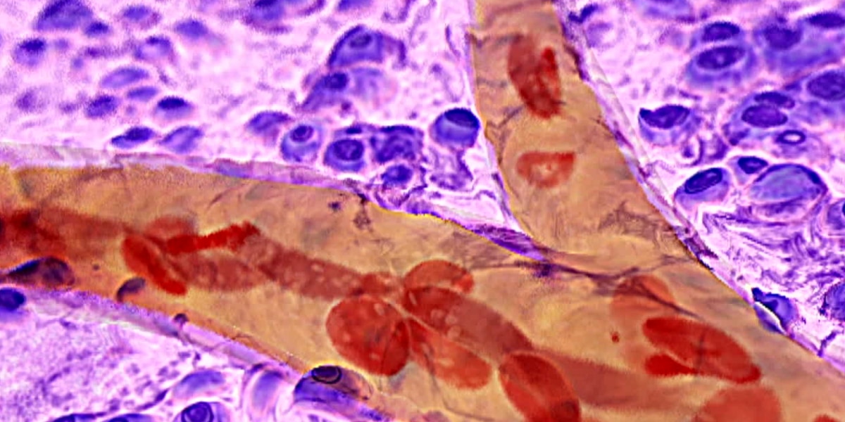 恋愛すると血液にどんな変化が起こるのか？