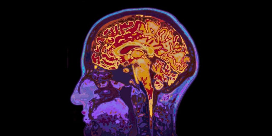 シスタチンCが開くアルツハイマー病治療の可能性