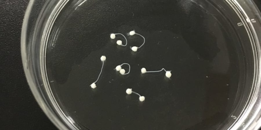 ヒト細胞で作った「ミニ脳」を神経で接続――東京大学が見た「会話する脳オルガノイド」の世界