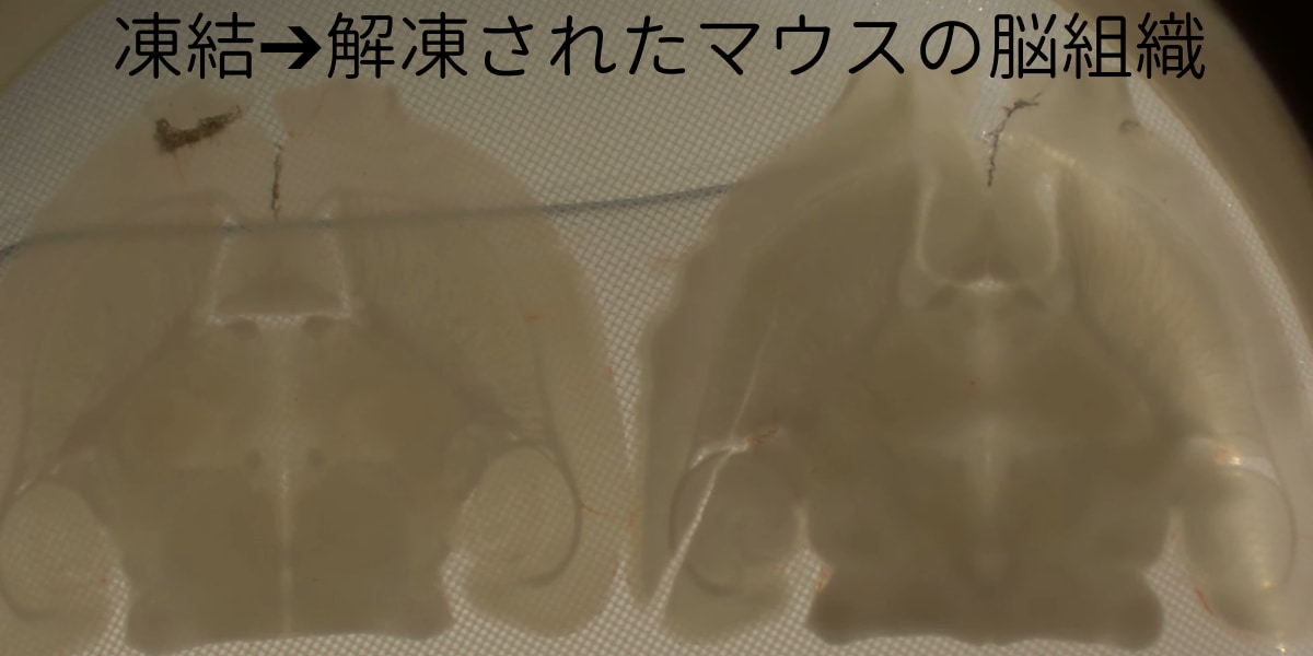 冷凍保存されたマウス脳の電気活動を再起動させることに成功