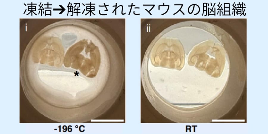 凍結➔解凍でも脳はまだ『学習』の仕組みを保っていた