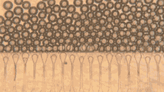 「ミニ肝臓」を注入する新技術、移植を待つ人の希望への画像 2/2