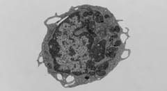 「死のタンパク質」が血を老化させていたと判明――ミトコンドリアのエネルギーを奪う