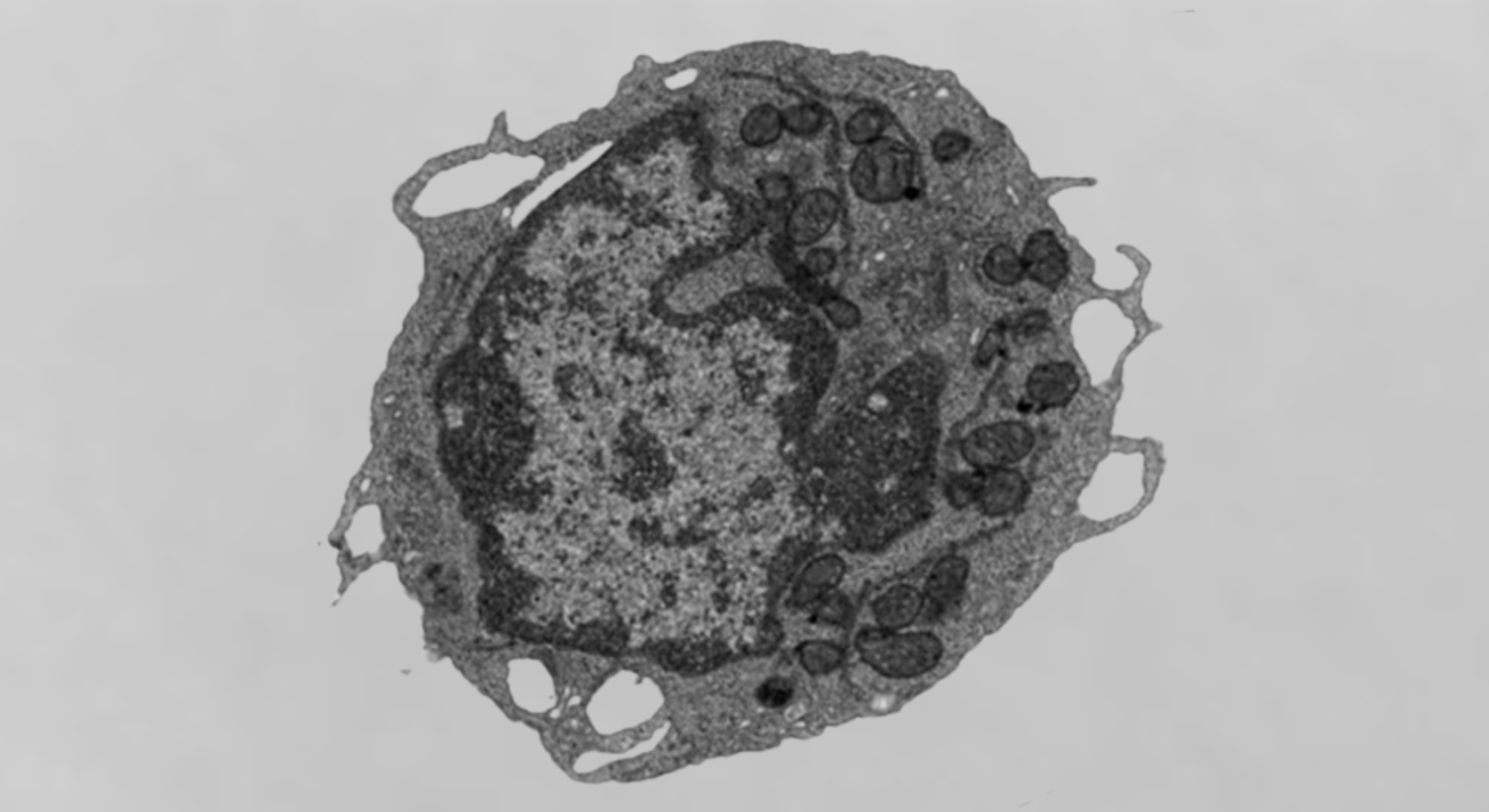 「死のタンパク質」が血を老化させていたと判明――ミトコンドリアのエネルギーを奪う