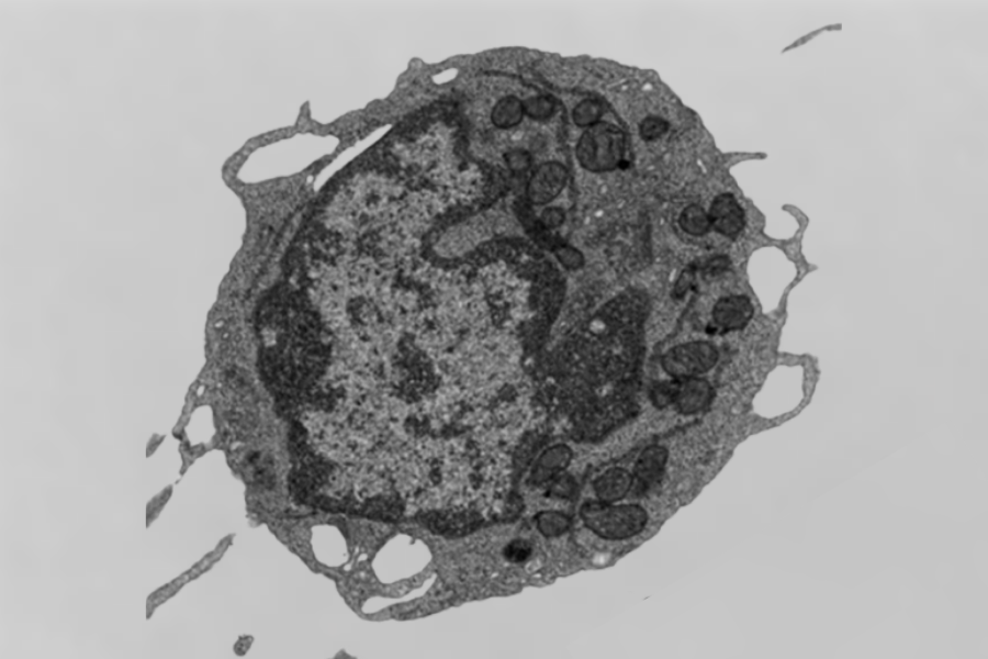 「死のタンパク質」が血を老化させていたと判明――ミトコンドリアのエネルギーを奪う