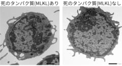 「死のタンパク質」が血を老化させていたと判明――ミトコンドリアのエネルギーを奪うの画像 3/5