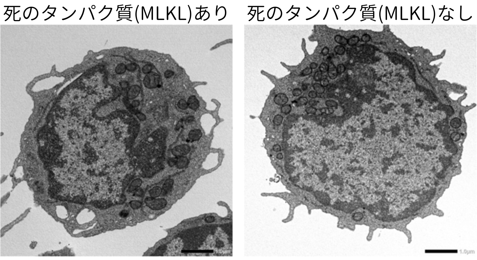 「死のタンパク質」が血を老化させていたと判明――ミトコンドリアのエネルギーを奪うの画像 3/5