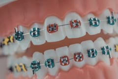 古代人に「歯の矯正」が必要なかった理由とは？の画像 2/2