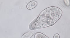 繊毛虫は何を取り込んでしまったのか？