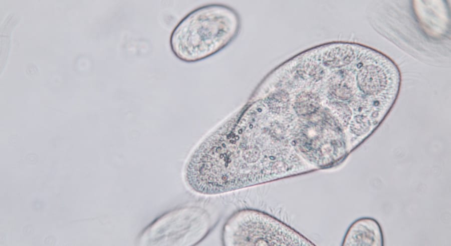 繊毛虫は何を取り込んでしまったのか?