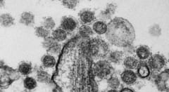 古代ウイルスの遺物がヒトの始まりを支えていた