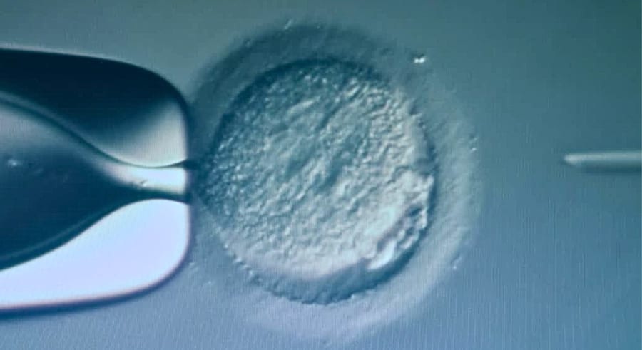 受精直後のヒトの卵で、3つの遺伝子を書き換える挑戦