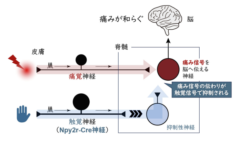 「痛いの痛いの飛んでいけ～」は本当に効いていた、医学的根拠を発見の画像 2/2