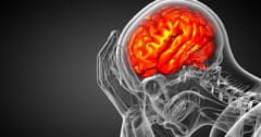 強い倦怠感が続く「慢性疲労症候群」、脳の掃除機能との関連を発見の画像 1/1