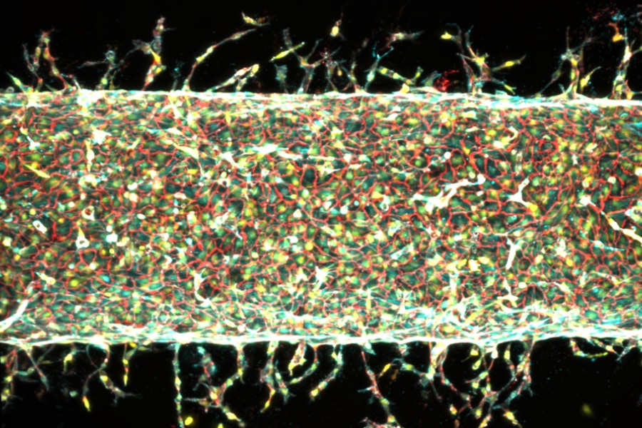 MITが磁石を使って人工血管を培養することに成功