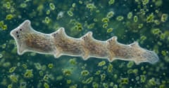 ワームに過度の餌を与えると、クローン個体が鎖状につながった「怪物」が誕生したの画像 1/3
