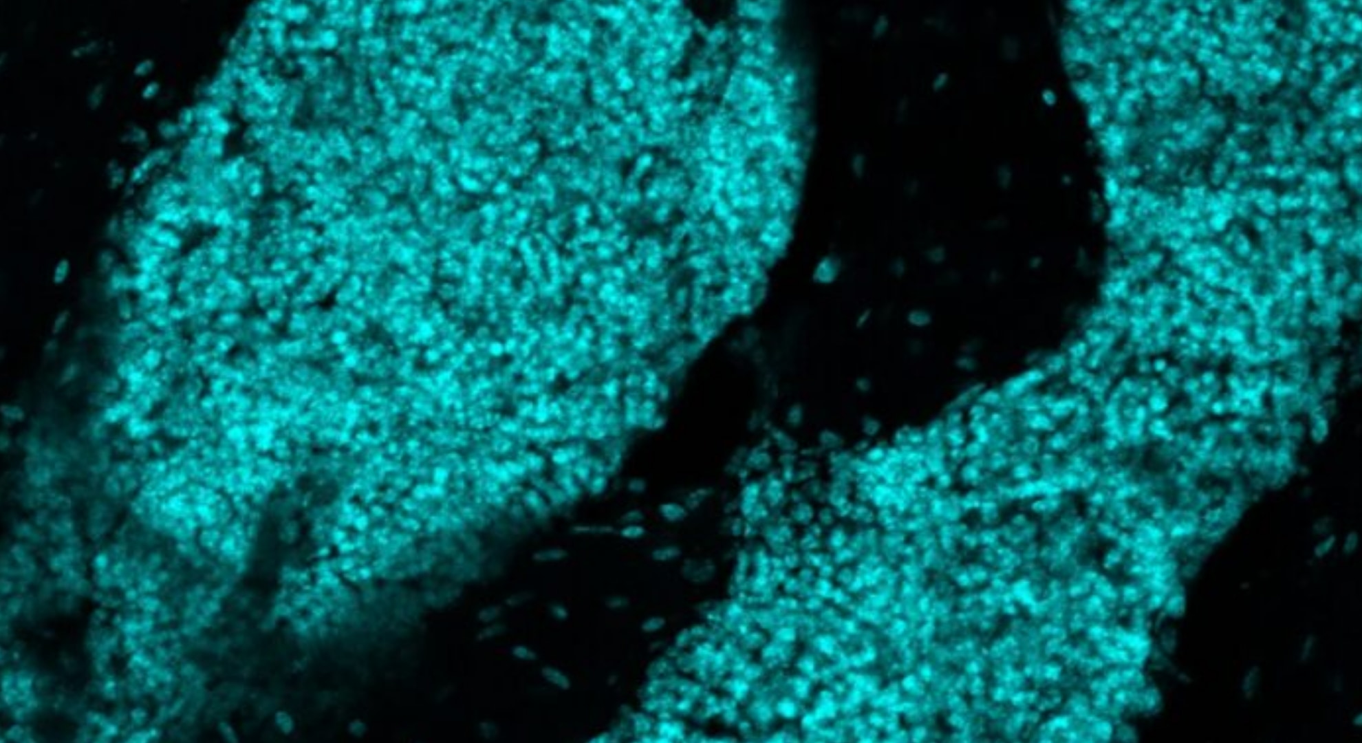 頭蓋骨の中に新たな「器官」を発見――そこは最前線で脳を守る免疫拠点だった