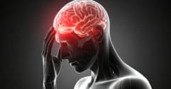 片頭痛患者の「記憶や感情に関わる66領域」で脳老化を確認の画像 1/1