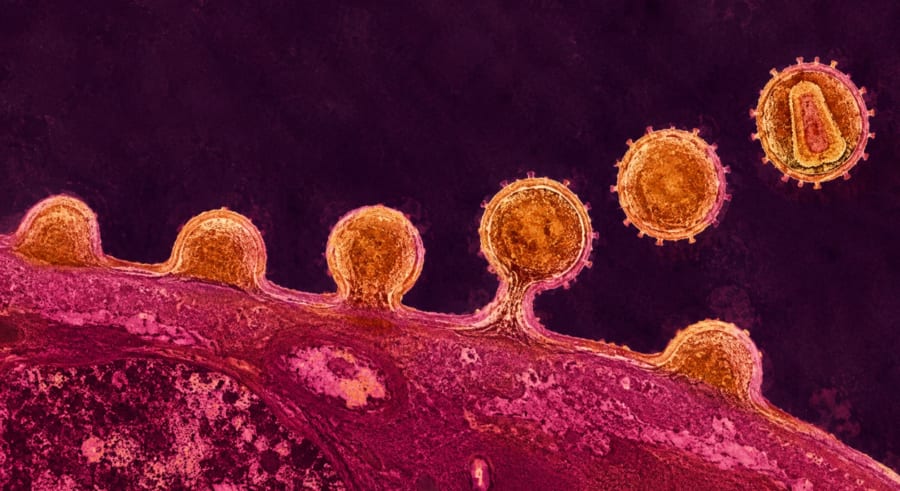HIVが「一生モノ」であり続けてきた理由